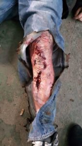 Blog 4 IMG 20171210 WA0003